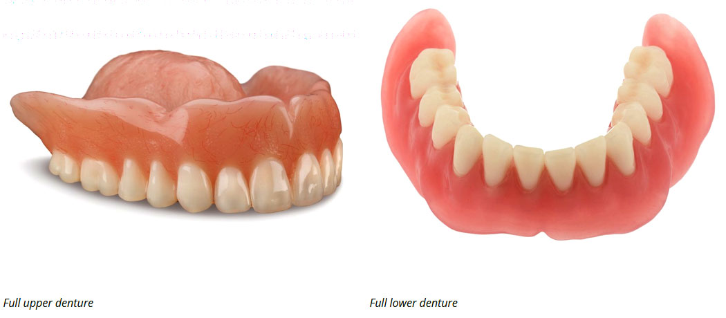 full denture