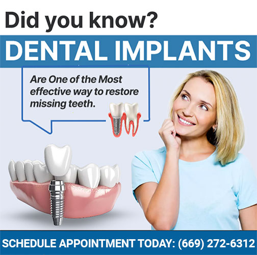 dental implants