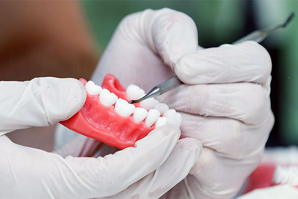 Dentures and Partials